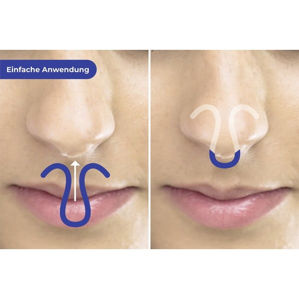 Щипки против хъркане в комплект 3 бр. – Maximex-image-1